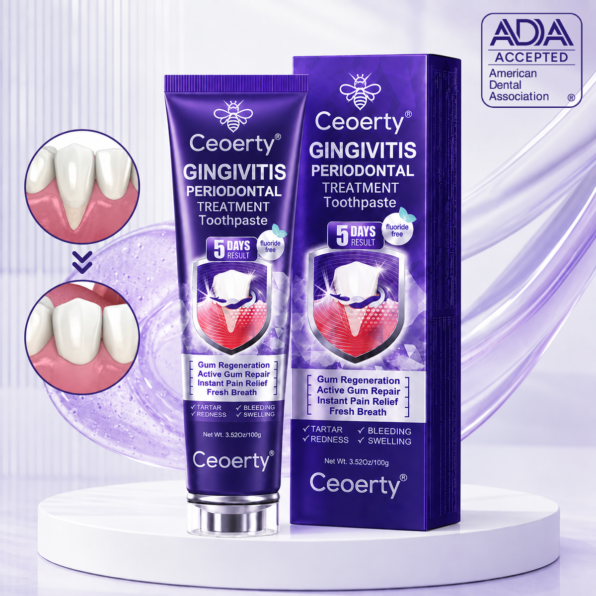 Ceoerty® Bee Venom Gum & Periodontal Toothpaste