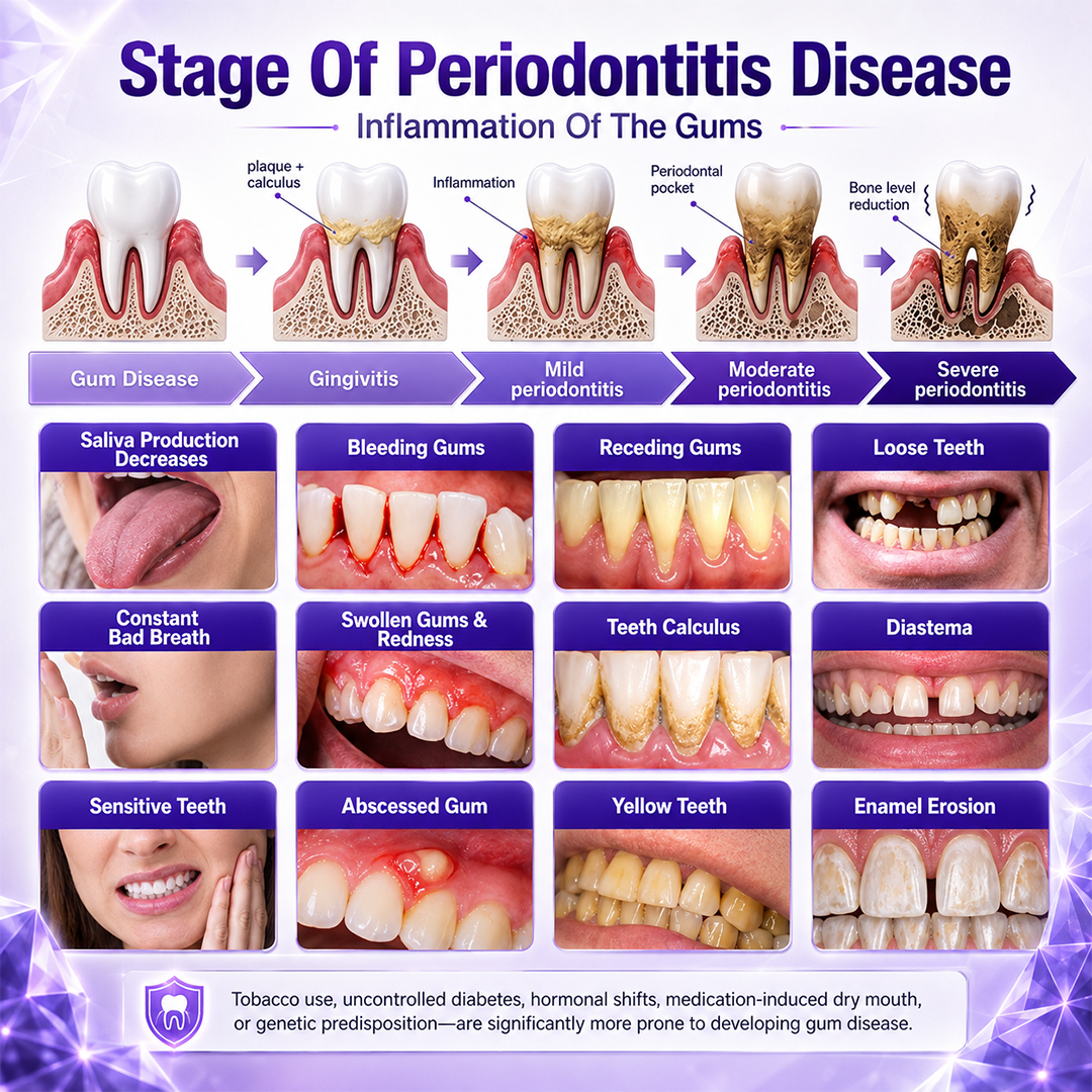 Ceoerty® Bee Venom Gum & Periodontal Toothpaste