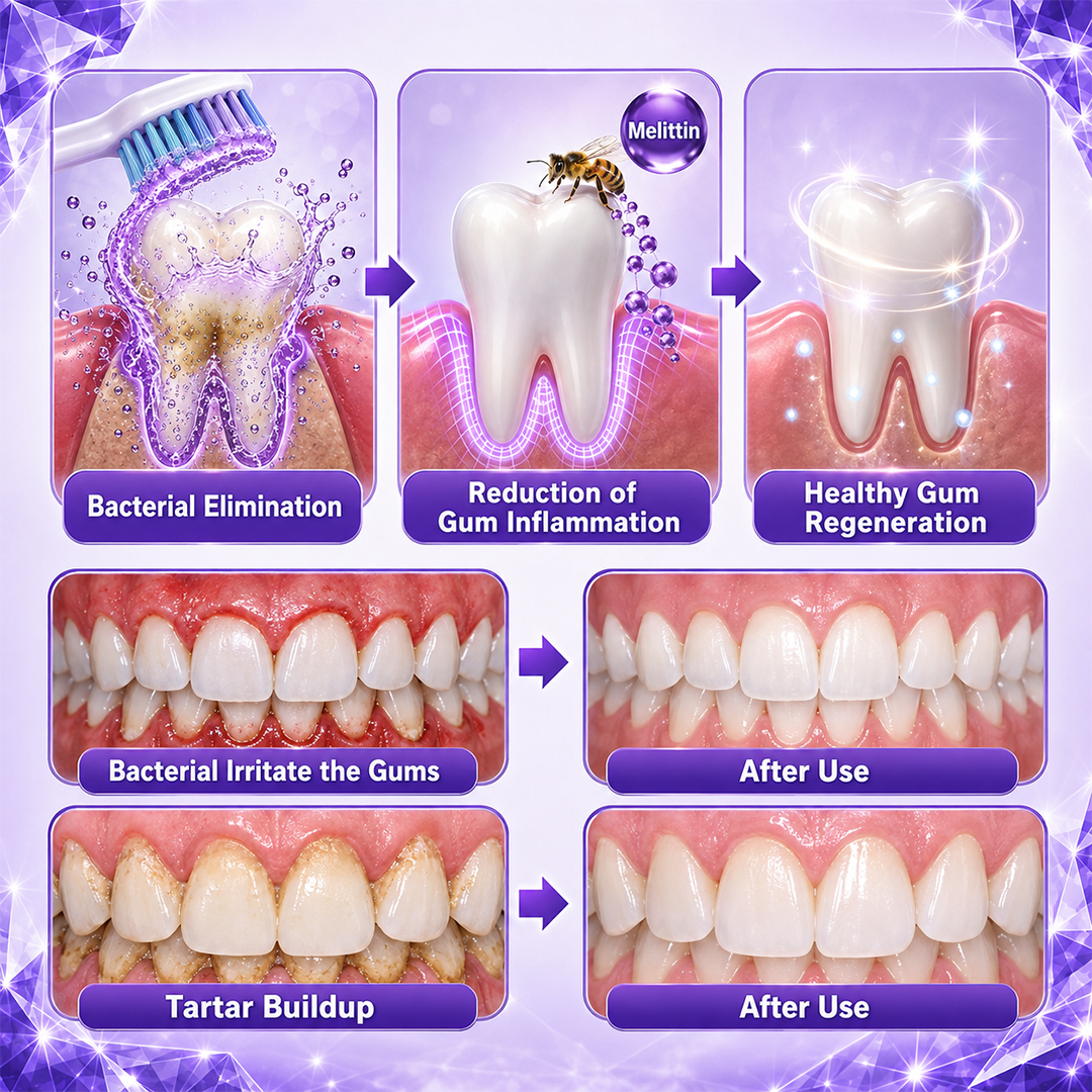 Ceoerty® Bee Venom Gum & Periodontal Toothpaste