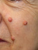 Before image for Linda Bennett