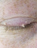 Before image for Cynthia Murphy